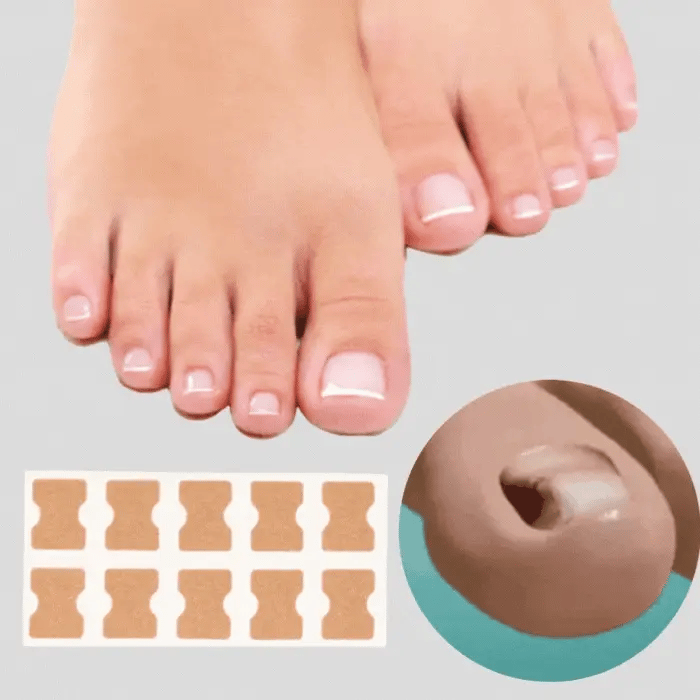 ToeFix+ Petice pentru unghii | Scapă de unghiile învinețite!
