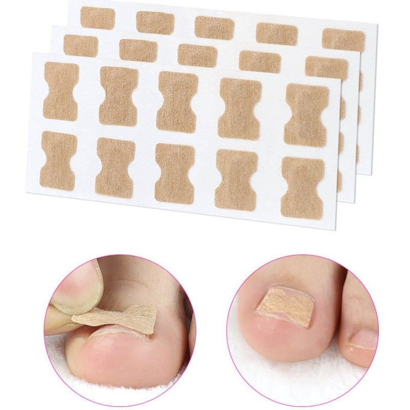 ToeFix+ Petice pentru unghii | Scapă de unghiile învinețite!