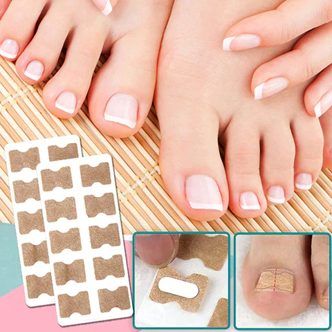 ToeFix+ Petice pentru unghii | Scapă de unghiile învinețite!