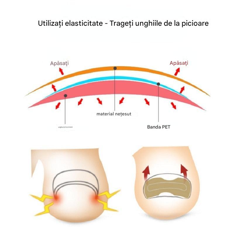 ToeFix+ Petice pentru unghii | Scapă de unghiile învinețite!