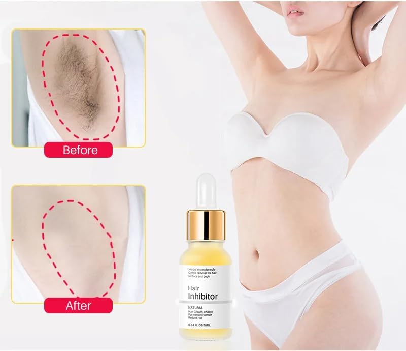 Seraphine™ Îndepărtarea perfectă a părului de pe corp